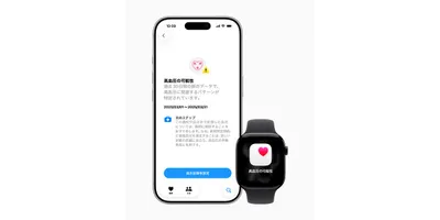 アップル、Apple Watch Series 9以降とApple Watch Ultra 2以降に...