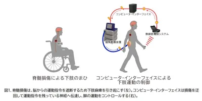 外科手術なしで脊髄損傷を迂回し信号を伝える手法、リハビリとしても有効か 